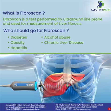 fibroscan nhs|who should get a fibroscan.
